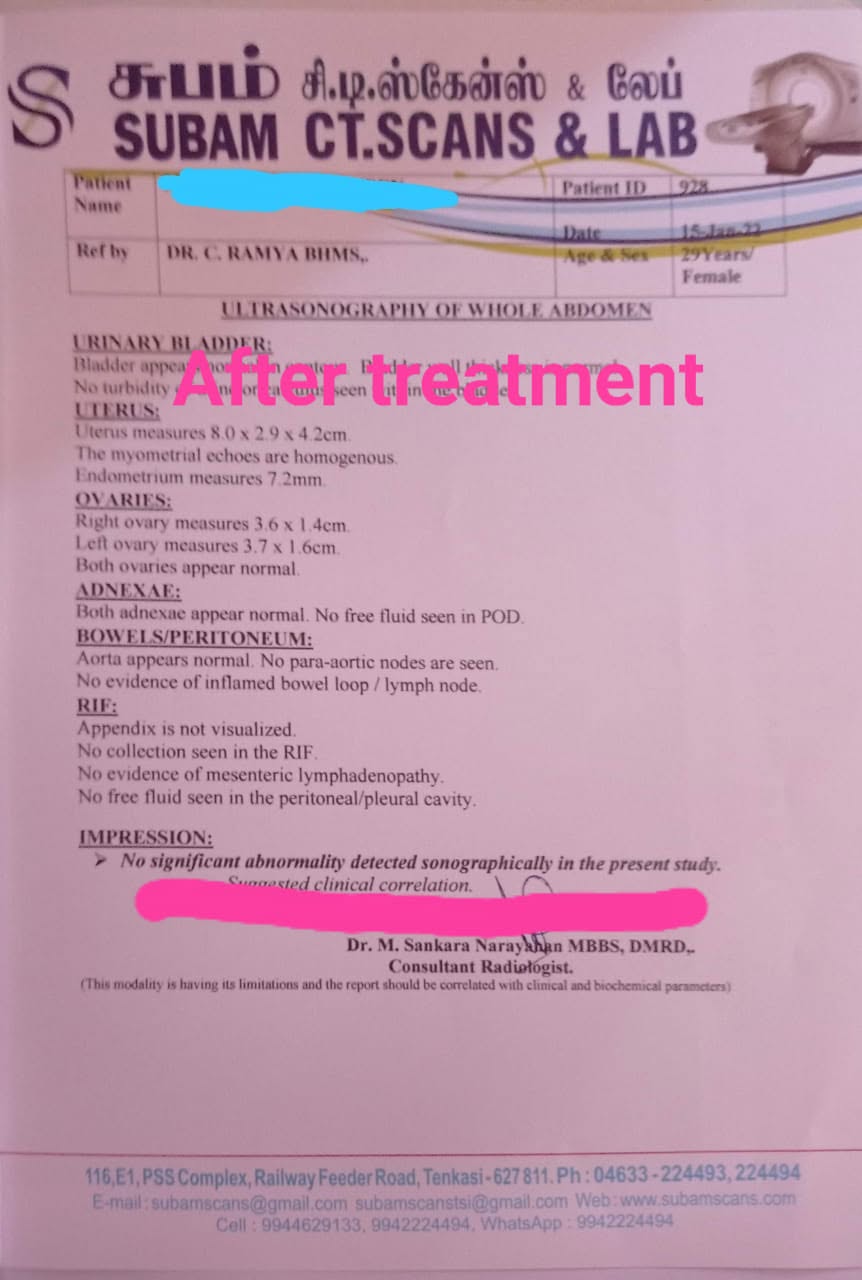AFTER scan report — Ovarian Varicocele
