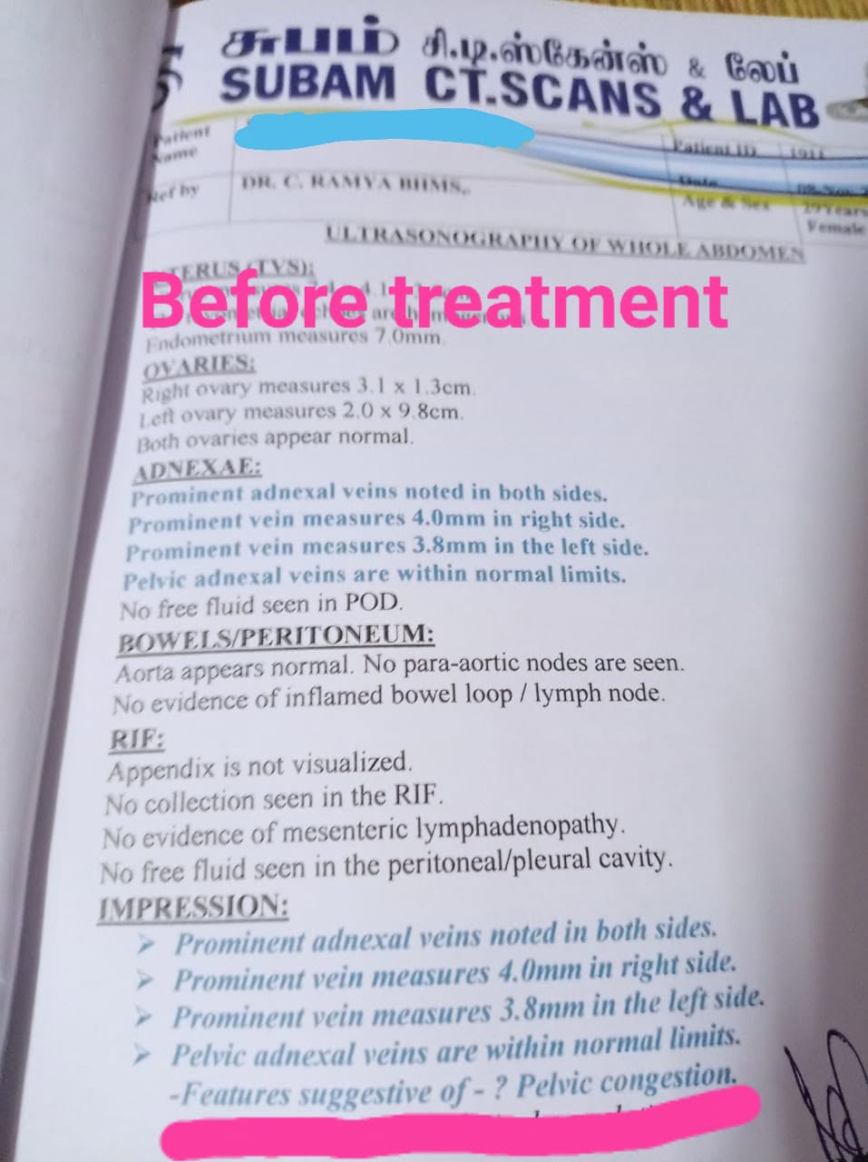 BEFORE scan report — Ovarian Varicocele